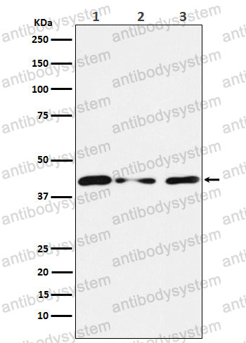 Anti-TINF2 Antibody (R2Q40)