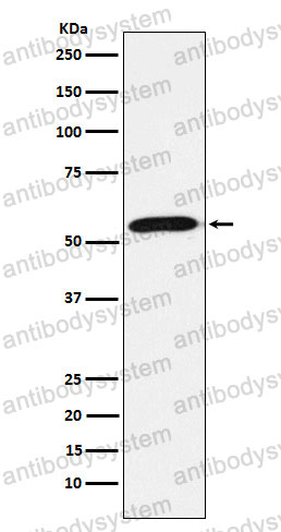 Anti-FBXO5 Antibody (R2Q41)