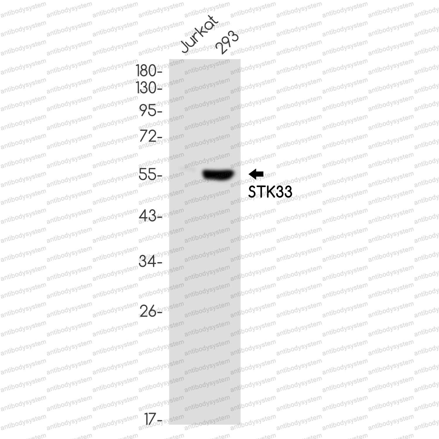 Anti-STK33 Antibody (R2Q43)