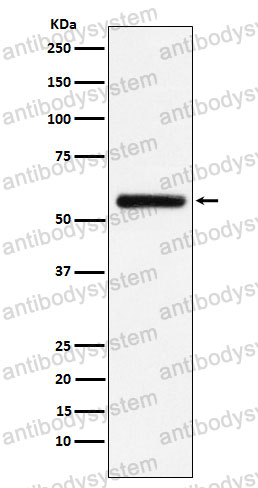 Anti-STK33 Antibody (R2Q42)