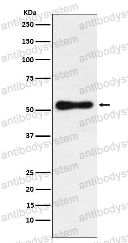 Anti-RORB Antibody (R2Q44)