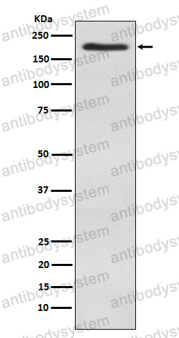 Anti-BAZ1B Antibody (R2Q46)