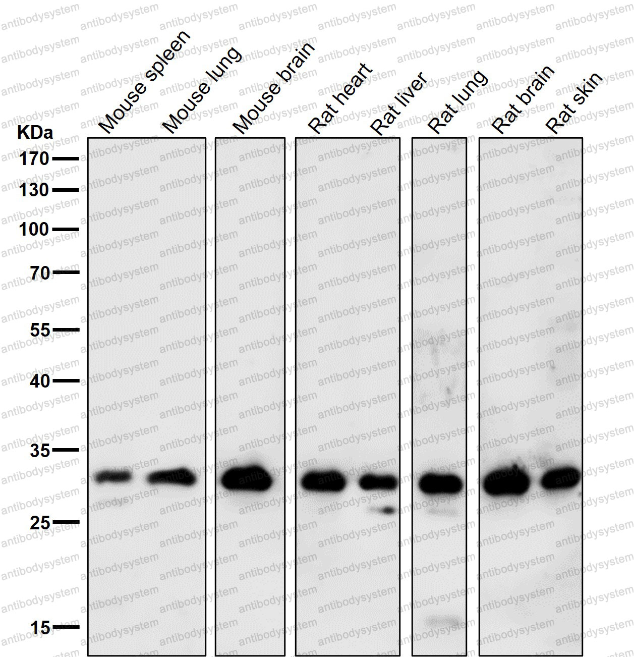 Anti-ALYREF Antibody (R2Q47)