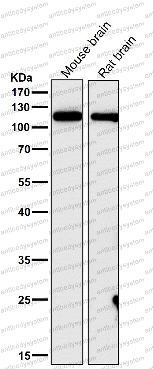 Anti-ARHGEF2 Antibody (R2Q49)