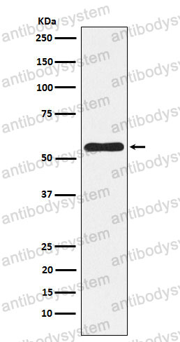 Anti-NLK Antibody (R2Q51)