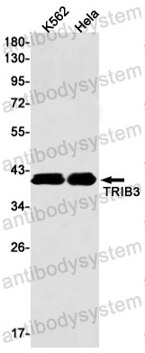 Anti-TRIB3 Antibody (R2Q54)