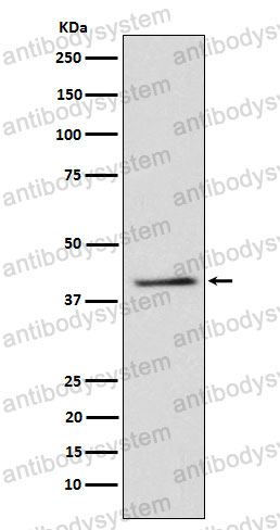 Anti-TRIB3 Antibody (R2Q53)