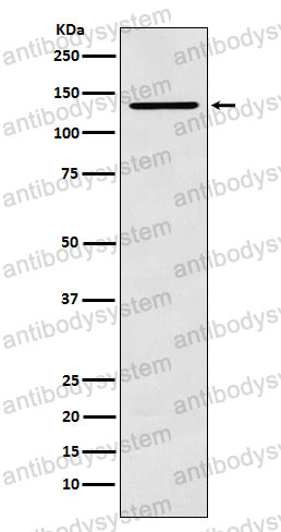 Anti-CARD11 Antibody (R2Q55)