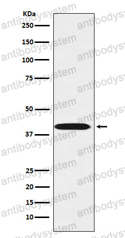 Anti-LHX3 Antibody (R2Q59)