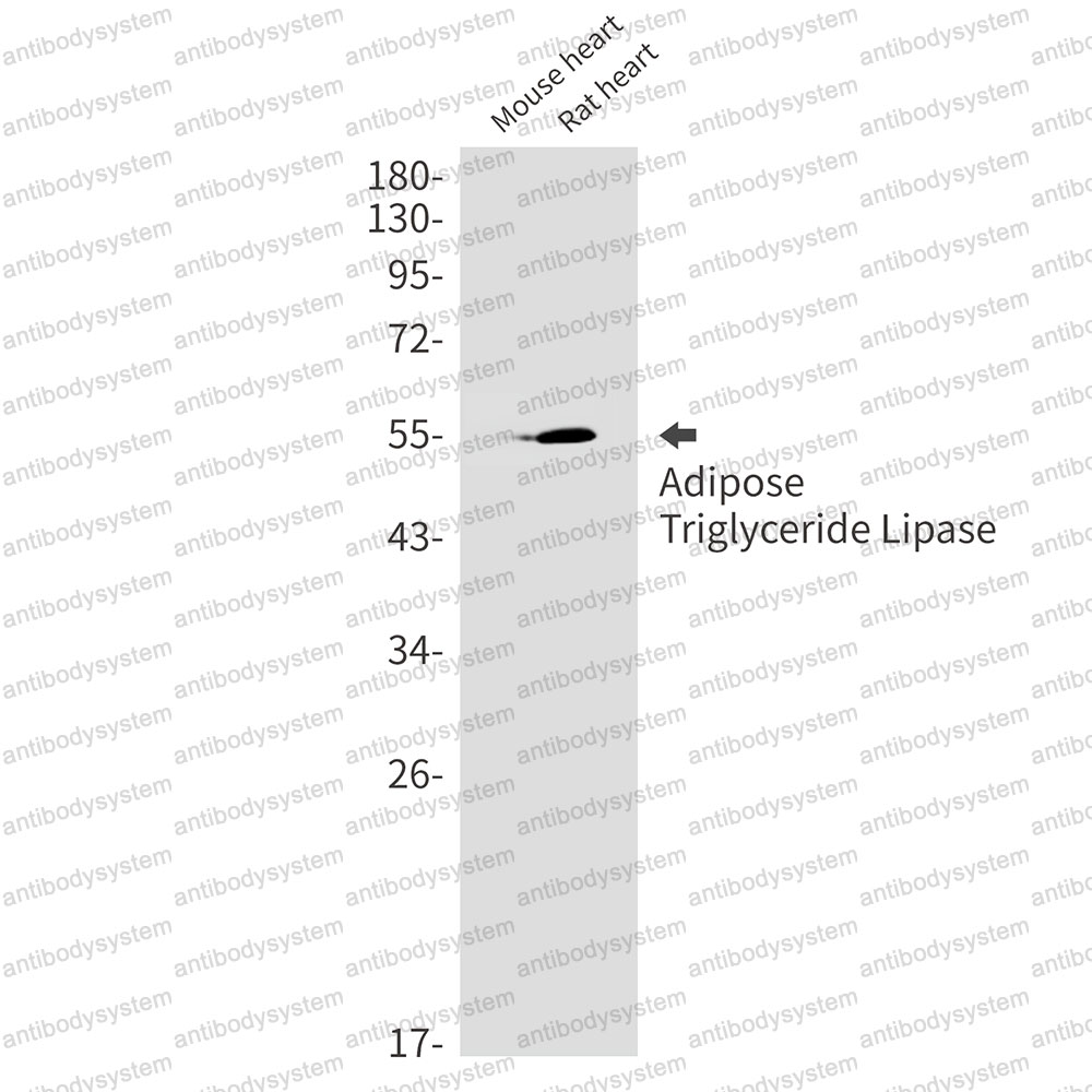 Anti-PNPLA2 Antibody (R2Q62)