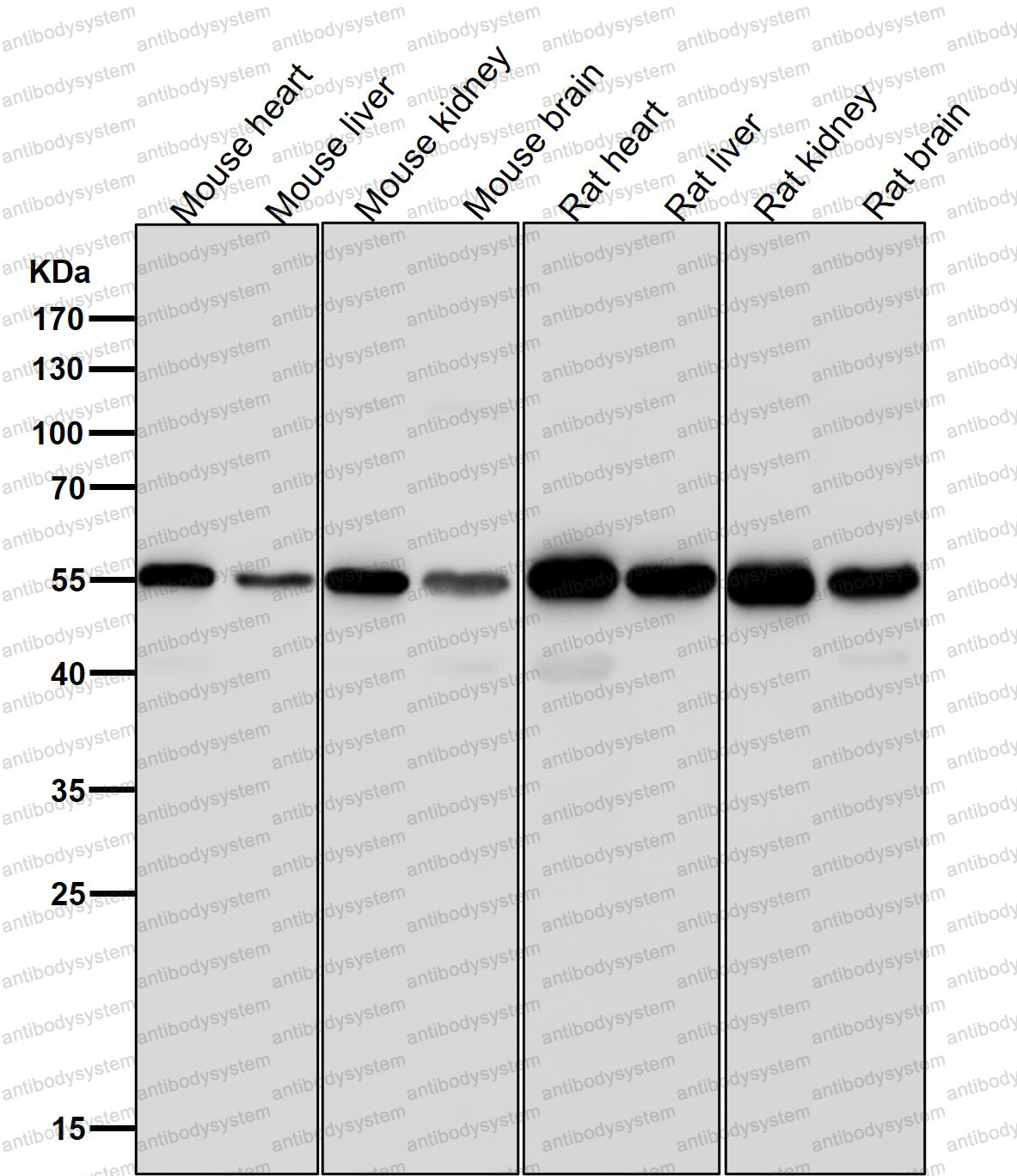 Anti-ATGL/PNPLA2 Antibody (R2Q60)