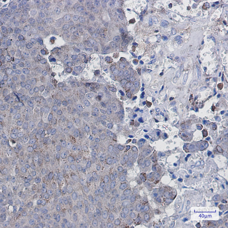 Anti-PNPLA2 Antibody (R2Q61)