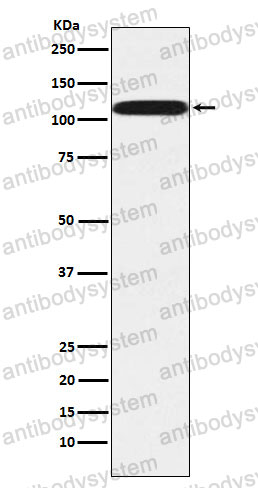 Anti-PUM2 Antibody (R2Q63)