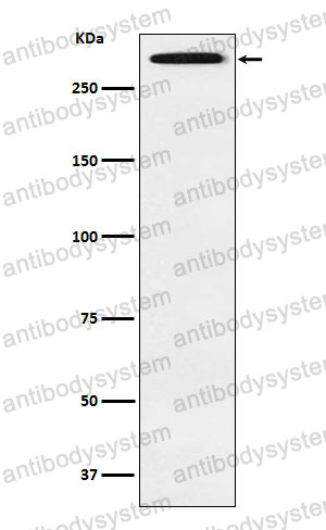 Anti-SMG1 Antibody (R2Q72)