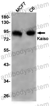 Anti-ZBTB33 Antibody (R2Q74)