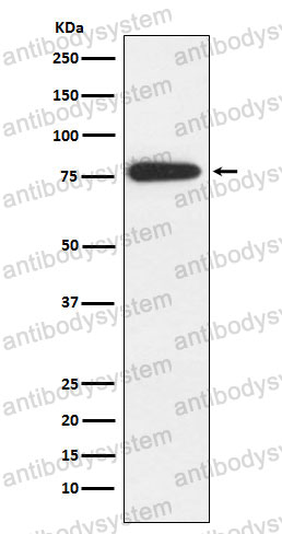 Anti-MARK2 Antibody (R2Q82)