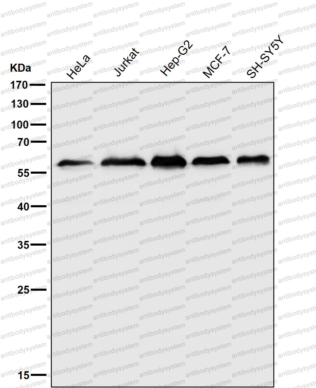 Anti-KLC3 Antibody (R2Q84)