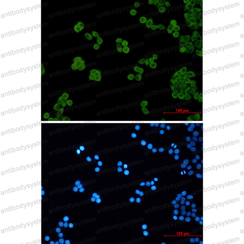 Anti-PSENEN Antibody (R2Q87)