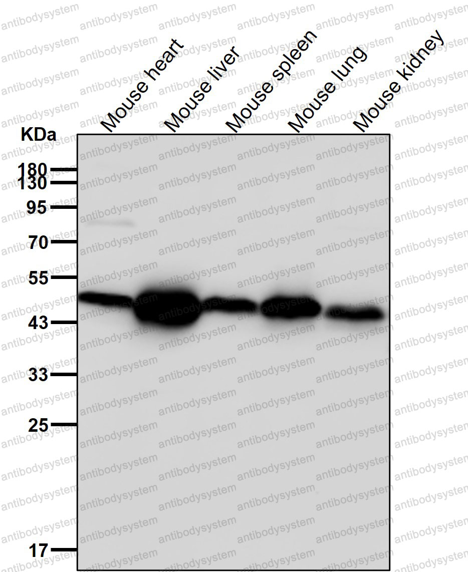 Western blot for Anti-ABHD5 Antibody (R2Q92) ?>