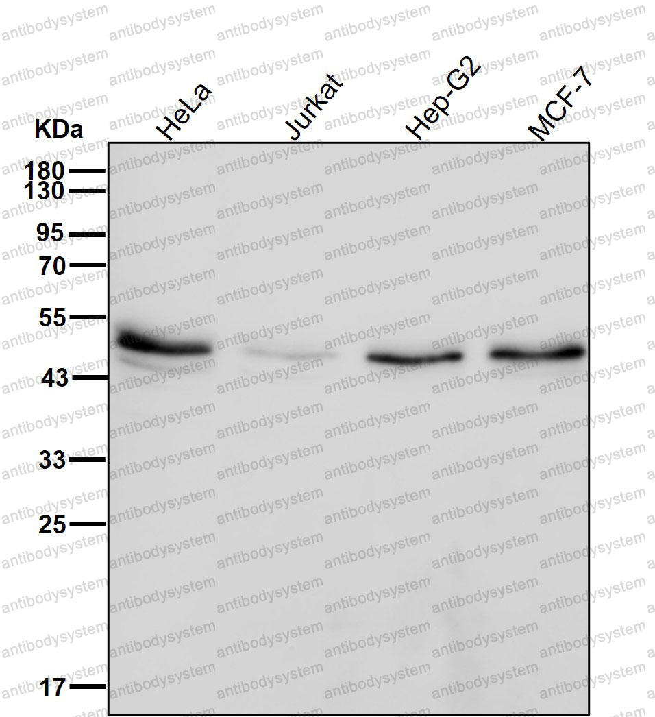 Western blot for Anti-ABHD5 Antibody (R2Q92) ?>