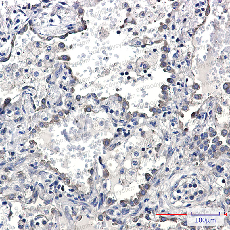 Anti-KIFAP3 Antibody (R2R20)