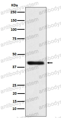 Anti-TMOD2 Antibody (R2R21)