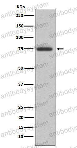 Anti-ABI2 Antibody (R2R22)