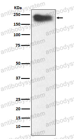 Anti-MYH7B Antibody (R2R23)