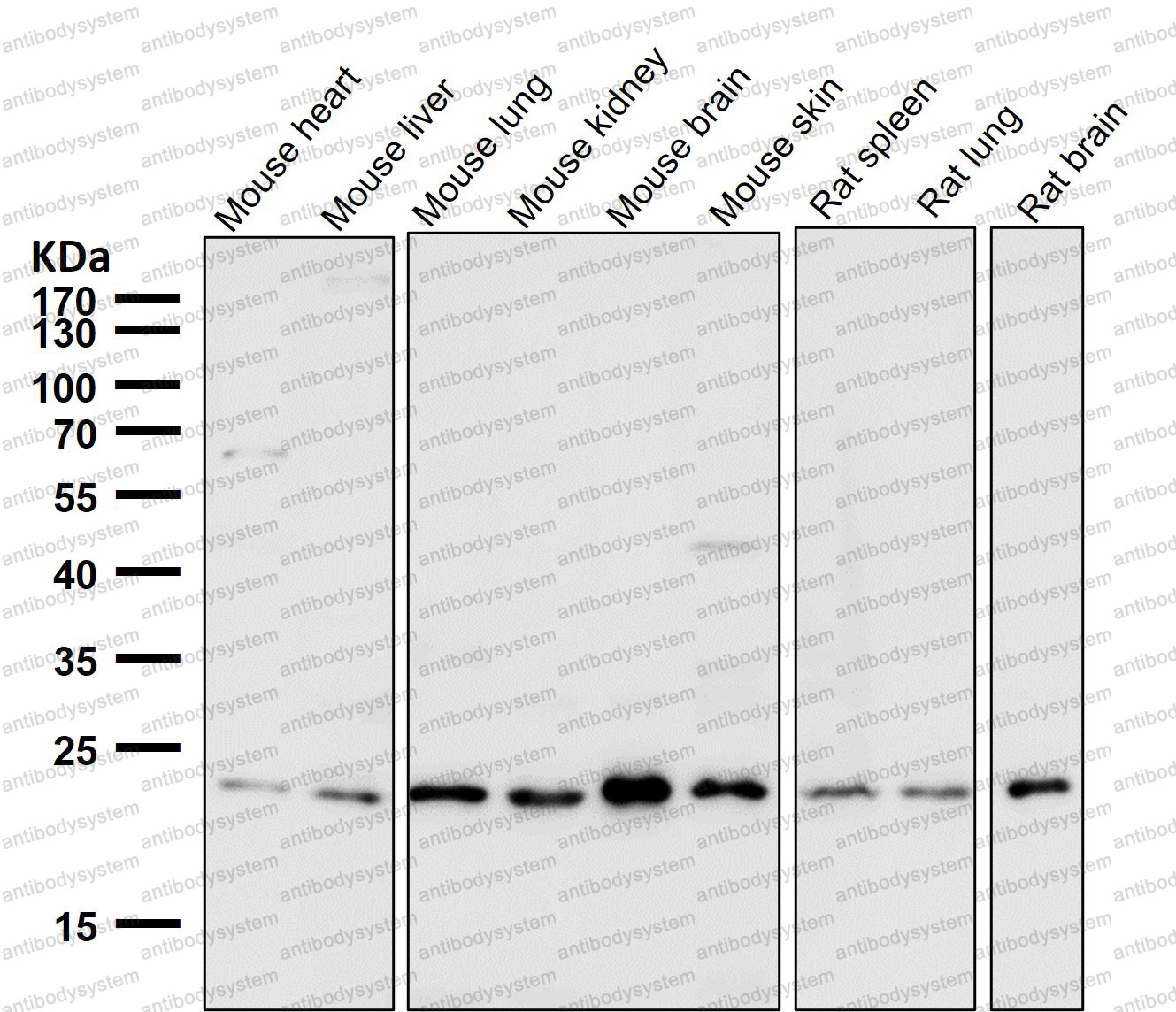 Anti-VPS28 Antibody (R2R25)