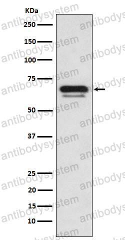 Anti-GATAD2A Antibody (R2R26)