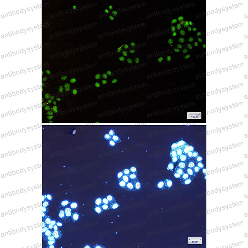 Anti-NAT10 Antibody (R2R28)