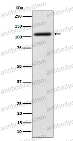 Anti-NAT10 Antibody (R2R27)