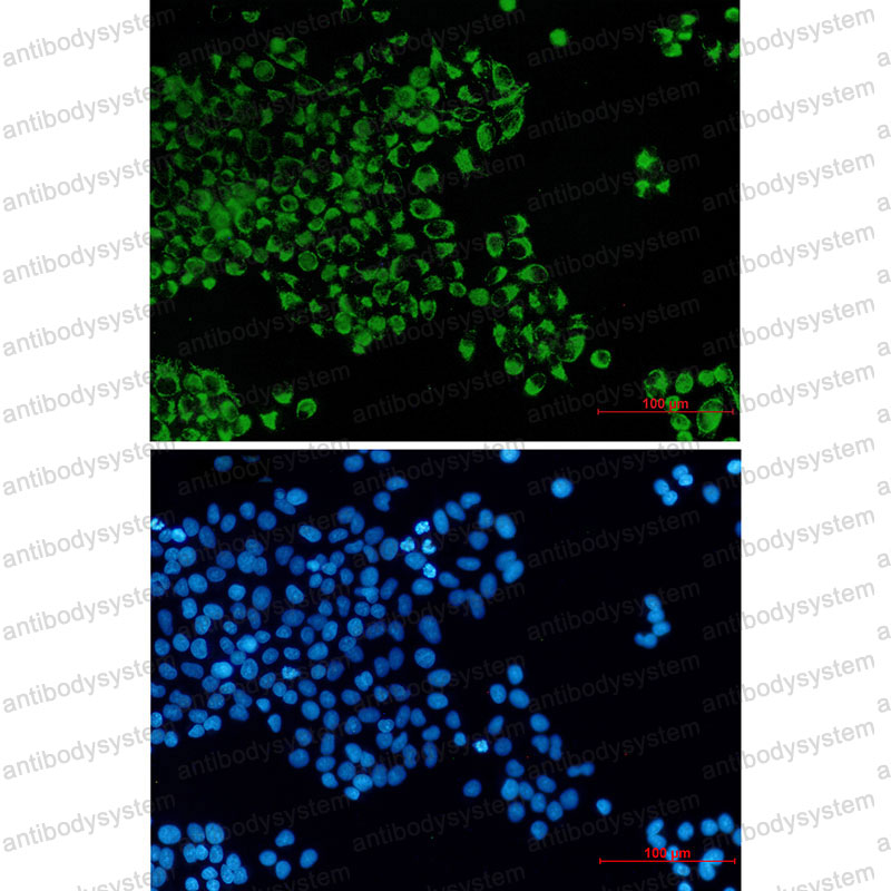 Anti-BCL2L14 Antibody (R2R30)