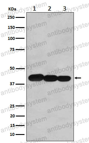 Anti-BCL2L14 Antibody (R2R29)