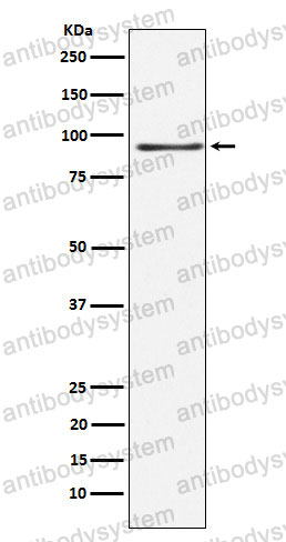 Anti-RANBP3 Antibody (R2R31)