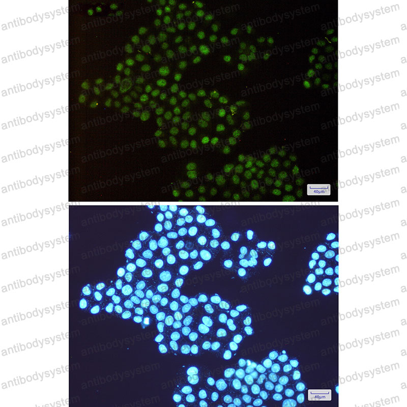 Anti-TRMT2A Antibody (R2R33)