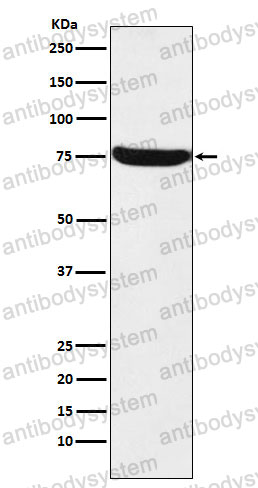 Anti-TRMT2A Antibody (R2R32)