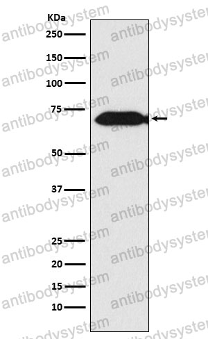 Anti-THEMIS Antibody (R2R34)