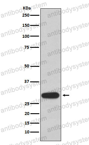 Anti-OLIG3 Antibody (R2R35)