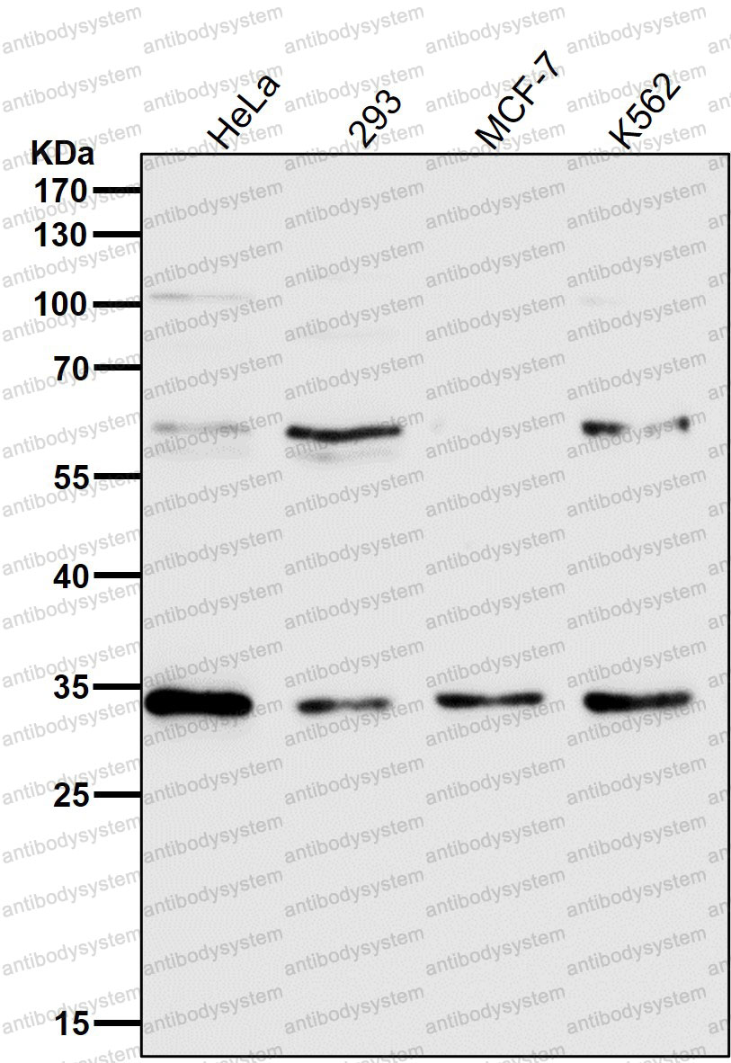 Anti-NUDT5 Antibody (R2R36)