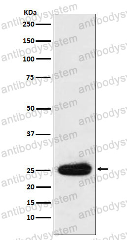 Anti-Human IGKV1D-16 Antibody (R2R37)
