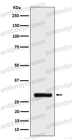 Anti-BRMS1 Antibody (R2R39)