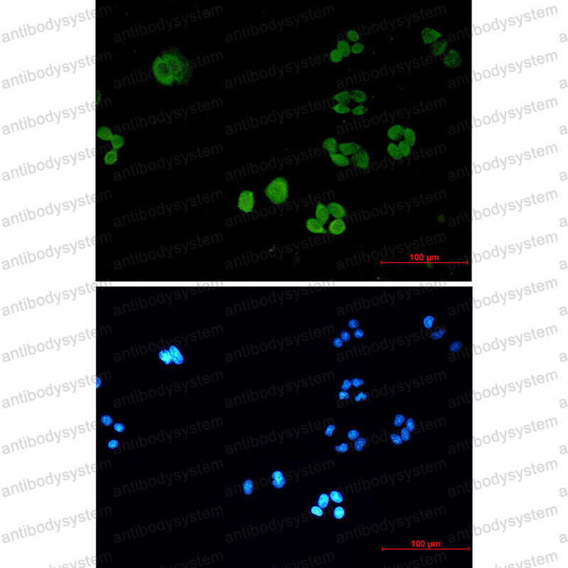 Anti-SBDS Antibody (R2R41)