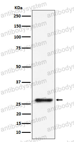 Anti-SBDS Antibody (R2R40)