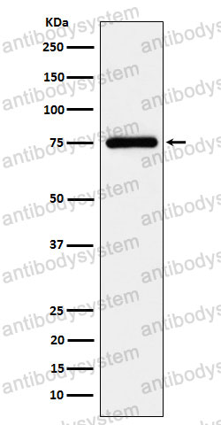 Anti-ASPSCR1 Antibody (R2R43)