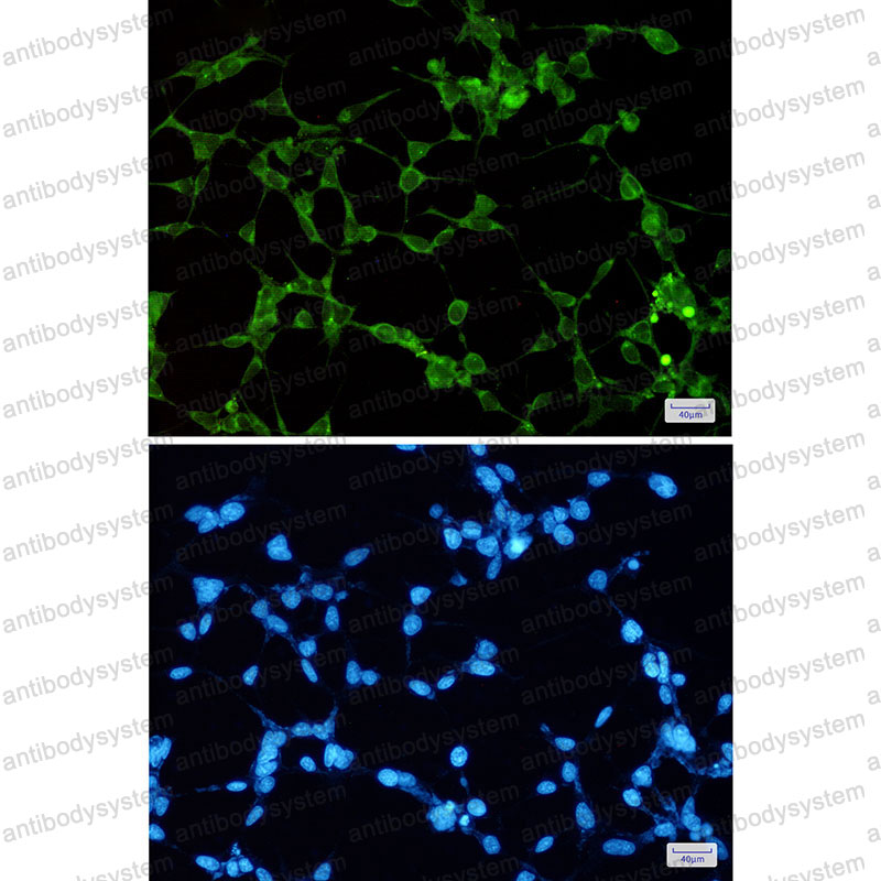 Anti-OSBPL1A Antibody (R2R46)