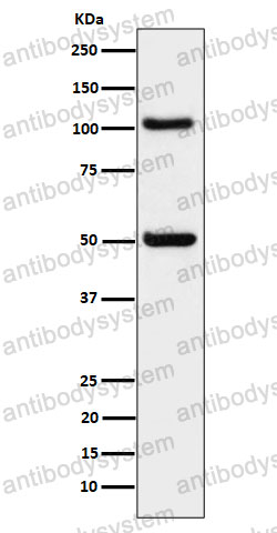 Anti-OSBPL1A Antibody (R2R45)