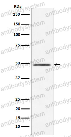 Anti-CLP1 Antibody (R2R47)
