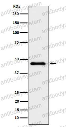 Anti-ELP4 Antibody (R2R48)