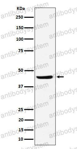 Anti-NDRG3 Antibody (R2R49)